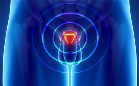 阴囊湿疹是什么原因引起的?